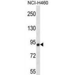 Chondroitin Sulfate Synthase 1 (CHSY1) Antibody