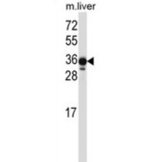 LIMS2 Antibody