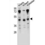 Protein Naked Cuticle Homolog 1 (NKD1) Antibody