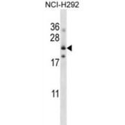 Folate Receptor Gamma (FOLR3) Antibody