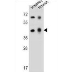 Adenosine Deaminase-Like Protein (ADAL) Antibody