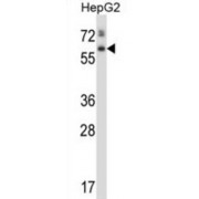 60 kDa Lysophospholipase (ASPG) Antibody