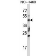 Tripartite Motif-Containing Protein 15 (TRIM15) Antibody