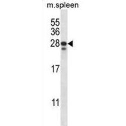 Ankyrin Repeat Domain-Containing Protein 22 (ANKRD22) Antibody