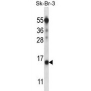 Transcription Factor BTF3 Homolog 4 (BTF3L4) Antibody