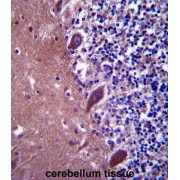 Tetratricopeptide Repeat Protein 13 (TTC13) Antibody