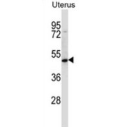 Protein Atonal Homolog 8 (ATOH8) Antibody