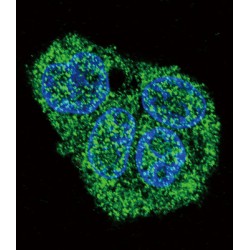 Pulmonary Surfactant-Associated Protein C (SFTPC) Antibody