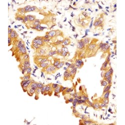 Pulmonary Surfactant-Associated Protein C (SFTPC) Antibody