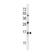 WB analysis of Jurkat cell line lysates.