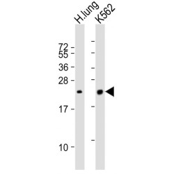 Pulmonary Surfactant-Associated Protein C (SFTPC) Antibody