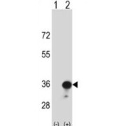 HLA Class II Histocompatibility Antigen, DR Beta 4 Chain (HLA-DRB4) Antibody