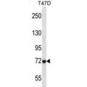 Matrix Metalloproteinase 2 (MMP2) Antibody