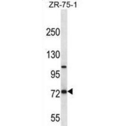 Glutamate Carboxypeptidase 2 (FOLH1) Antibody