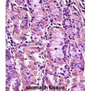 Synaptotagmin 1 (SYT1) Antibody