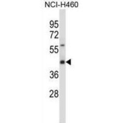 Synaptotagmin 1 (SYT1) Antibody