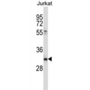 T-Cell Antigen CD7 (CD7) Antibody