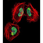 Histone Deacetylase 4 (HDAC4) Antibody