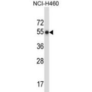 Matrix Metalloproteinase 8 (MMP8) Antibody