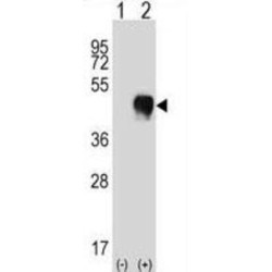 Fc Fragment of IgG, Low Affinity IIa, Receptor / CD32 (FCGR2A) Antibody