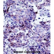 Cortactin (CTTN) Antibody