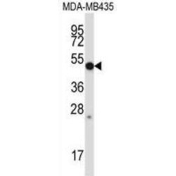 Matrix Metalloproteinase 28 (MMP28) Antibody