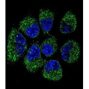 Tumor Necrosis Factor Receptor Superfamily Member 11B (TNFRSF11B) Antibody