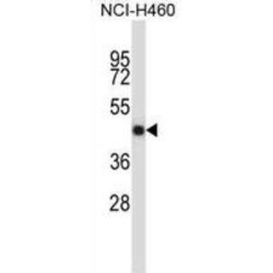 Tumor Necrosis Factor Receptor Superfamily Member 11B (TNFRSF11B) Antibody