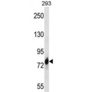 Cadherin 16 (CDH16) Antibody