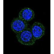 Menin (MEN1) Antibody