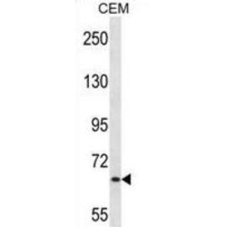 Menin (MEN1) Antibody