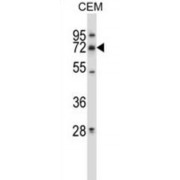 Matrix Metalloproteinase 19 (MMP19) Antibody