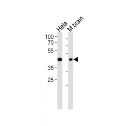 TAR DNA-Binding Protein 43 / TDP43 (TARDBP) Antibody