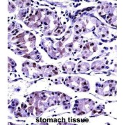 Protein Phosphatase 2 Catalytic Subunit Beta (PPP2CB) Antibody