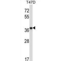 Protein Phosphatase 2 Catalytic Subunit Beta (PPP2CB) Antibody