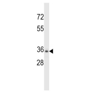 Western blot analysis of NCI-H460 cell lysates (35 µg/lane) using Chymotrypsin Like Elastase Family Member 3B (CELA3B) Antibody.