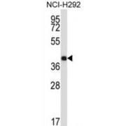 Synaptotagmin 2 (SYT2) Antibody