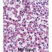 Nicotinamide N-Methyltransferase (NNMT) Antibody