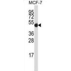 GDP Dissociation Inhibitor 2 (GDI2) Antibody