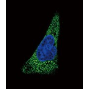 Natural Resistance-Associated Macrophage Protein 2 (SLC11A2) Antibody