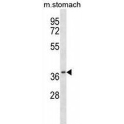 Casein Kinase 2 Alpha 2 (Csnk2a2) Antibody
