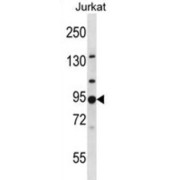 AP-1 Complex Subunit Gamma-Like 2 (AP1G2) Antibody