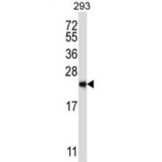 RAB1B, Member RAS Oncogene Family (RAB1B) Antibody