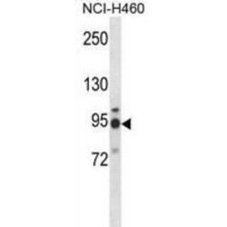 Mannosyl Alpha-1,6-Glycoprotein Beta-1,6-N-Acetylglucosaminyltransferase (MGAT5) Antibody