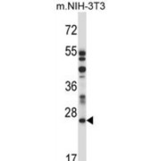 Lysosomal Protein Transmembrane 4 Alpha (LAPTM4A) Antibody