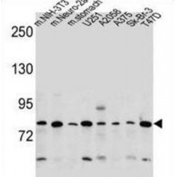 Discoidin, CUB And LCCL Domain Containing Protein 2 (DCBLD2) Antibody