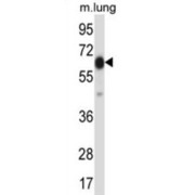 Premature Ovarian Failure, 1B (POF1B) Antibody