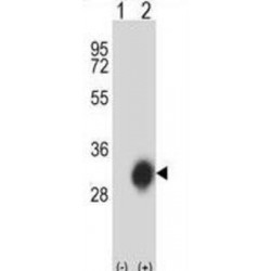 HLA Class II Histocompatibility Antigen, DP Beta 1 Chain (HLA-DPB1) Antibody