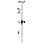 Centromere Protein A (CENPA) Antibody