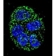 Anterior Gradient Protein 2 Homolog (AGR2) Antibody